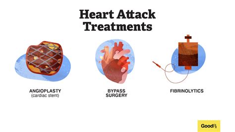 tivacy|A Treatment Option 